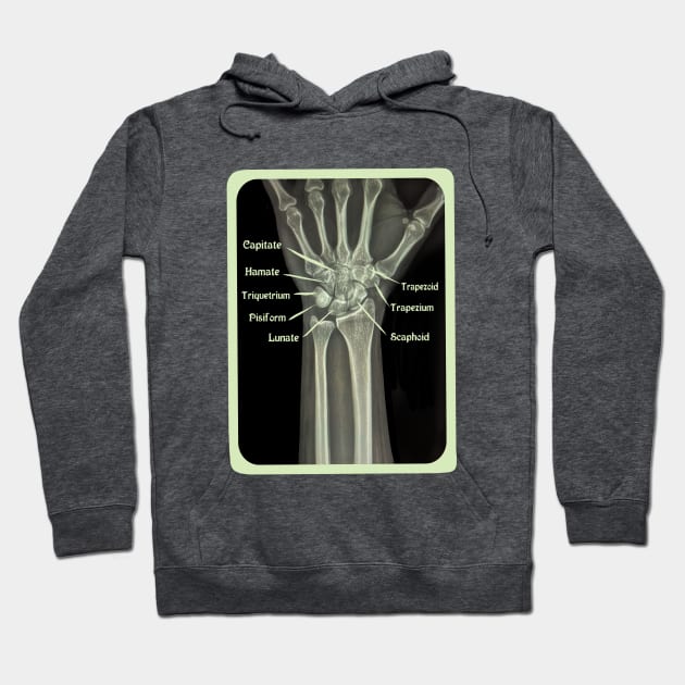 XRAY of Carpal Bones Mixed Media Hoodie by ckrickett